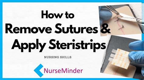 How To Remove Sutures And Apply Steristrips Nursing Skills Youtube