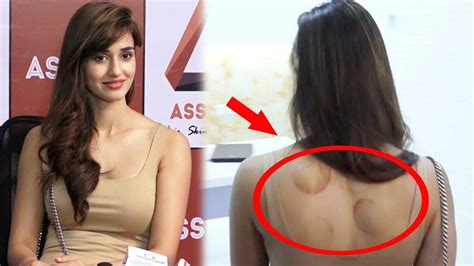 Tiger Shroff S Girlfriend Disha Patani Spotted With Marks On Her Back