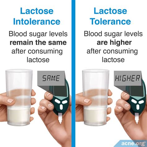 Does Lactose Intolerance Relate To Acne