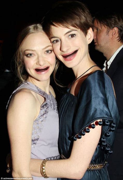 Anne Hathaway And Amanda Seyfried Are Toothless In Funny Airbrushed