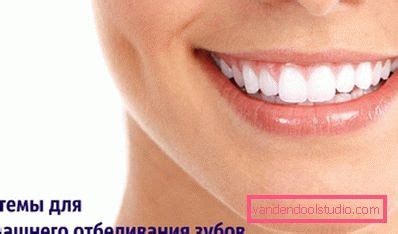 In der zahnarztpraxis oder mit strips zu hause? Weiße zähne, die zu hause weiß werden - Frisur Blog