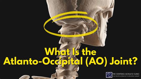 What Is The Atlanto Occipital Ao Joint Centeno Schultz