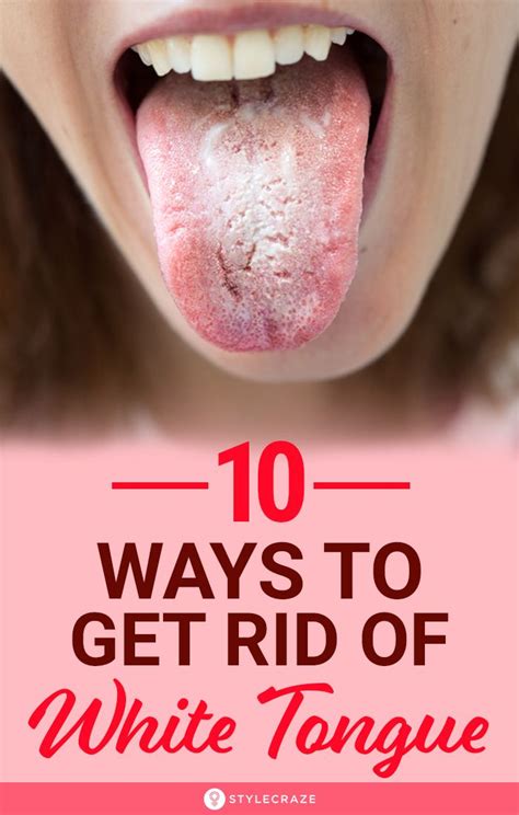 10 Ways To Get Rid Of White Tongue And Make It Healthier The Tongue Is