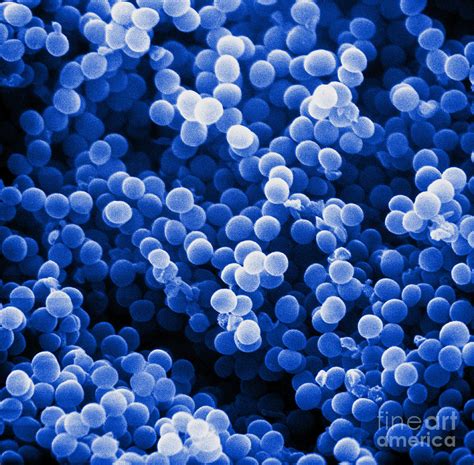 Staphylococcus Aureus Sem Photograph By David M Phillips Fine Art