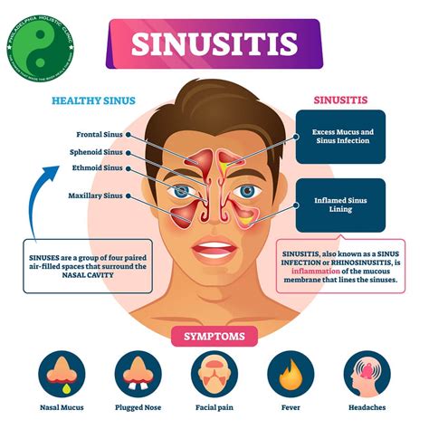 Homeopathic Treatment For Sinusitis And Nasal Congestion