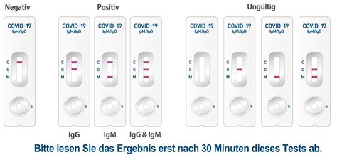 Es kann neben dem nasopharyngealen abstrich auch der nasale abstrich gemacht werden ! Covid-19 Rapid Antikörpertest von Genedia - jetzt ...