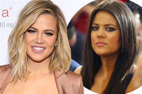 Khloe Kardashian 2016 Plastic Surgery Before And After