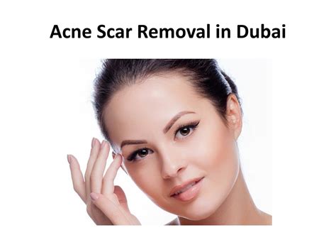 Ppt Acne Scar Removal In Dubai Powerpoint Presentation Free Download