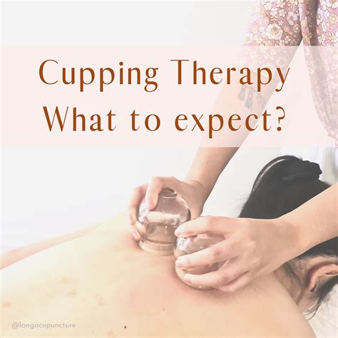 Cupping Therapy What To Expect