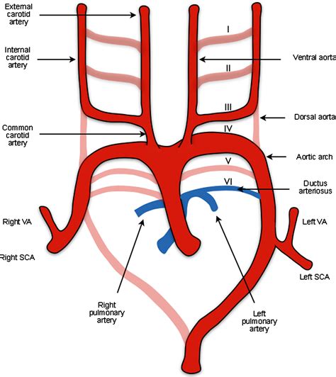 Frequency Of Variations In Aortic Arch Anatomy Depicted On