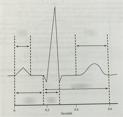 E17 Labeling Normal Ecg Diagram Quizlet