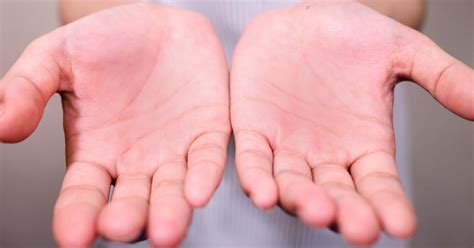 Por qué pueden inflamarse o ponerse coloradas las palmas de las manos