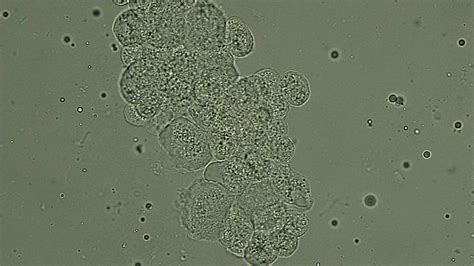 Epithelium cells tubular (renal) epithelium cells are absent normally in the urine. Urinalysis Archives | eClinpath