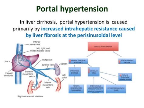 Some of the symptoms may be nonspecific, that is, they don't suggest that the liver is their cause. Portal Hypertension Specialist in Mumbai, Maharashtra | Dr ...