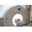 Radiation From CT Scans May Increase Risk Of Brain Cancer  The Indian Wire