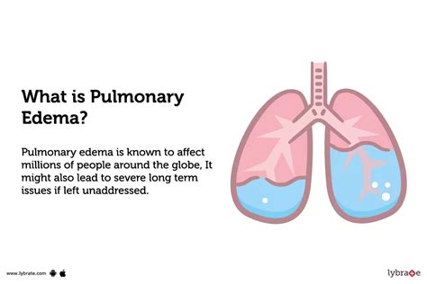 Pulmonary Edema Symptom Causes Treatment And Prevention