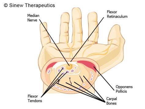 The muscles of the upper arm are responsible for the flexion and extension of the forearm at the elbow joint. Carpal Tunnel Syndrome Information - Sinew Therapeutics