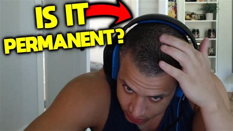 Tyler1 Head Dent Youtube