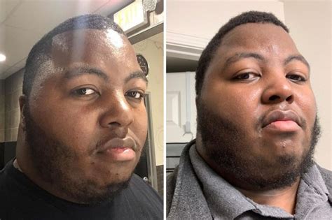 Minoxidil should not be used 24 hours before and after the hair treatment procedure. The Struggle to Grow a Beard Is Real. So Men Are Faking It ...