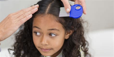 Head Lice And Nits Risk Detection Treatment And Prevention