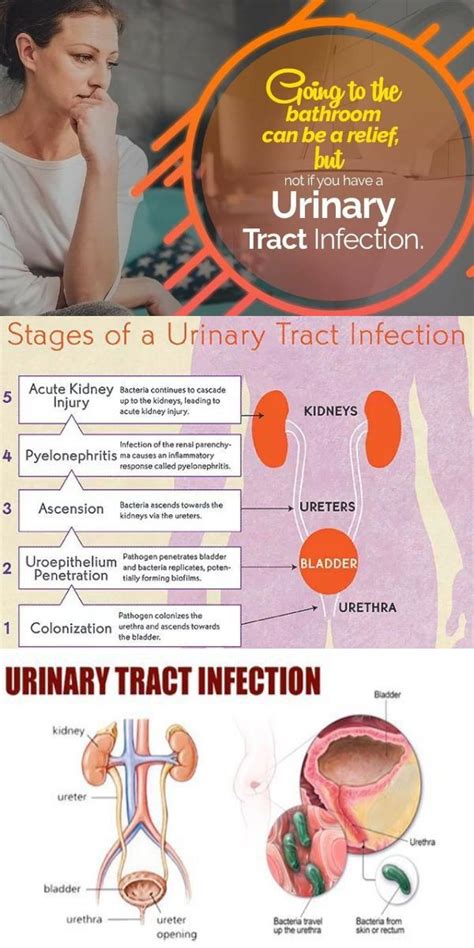 Urinary Tract Infection Men