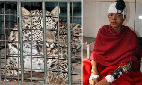 Akila Bibi Pregnant Woman 20s Suffers Horrific Injuries In Leopard