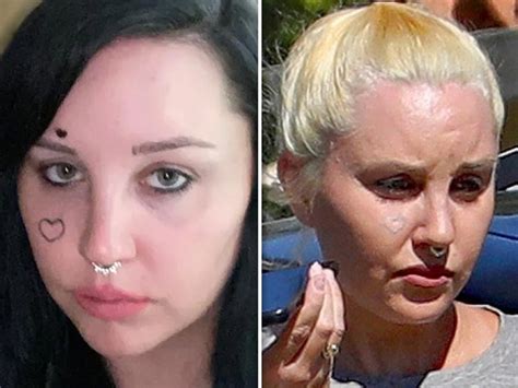 Amanda Bynes Appears To Be Removing Face Tattoo After Mental Health
