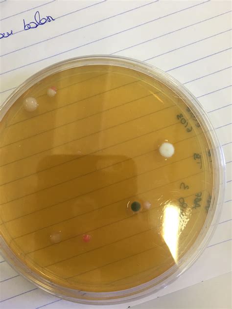 Open To Air Plate With Agar For Fungus Rmicrobiology