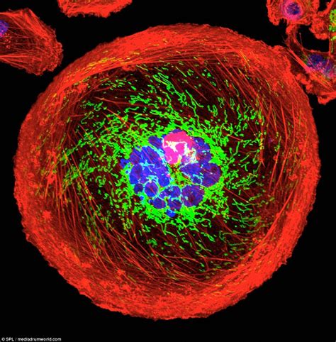 What Cancer Looks Like Under Fluorescent Lights And 3d Scans Daily