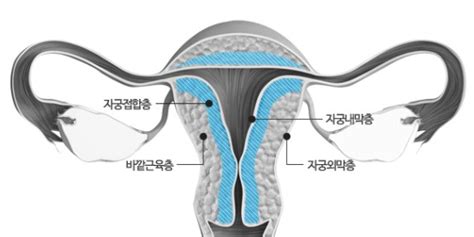 자궁의 내막층과 연동운동의 중요성