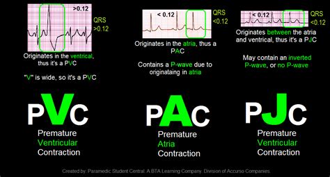 Paramedic Student Central Pvc Pac Pjc Quick Reference Tool