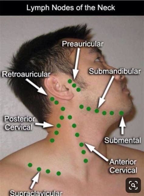 Is It Normal To Feel Lymph Nodes In The Neck Lymph Nodes Anatomy Of