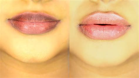 how to lighten dark lips fast naturally easy method youtube