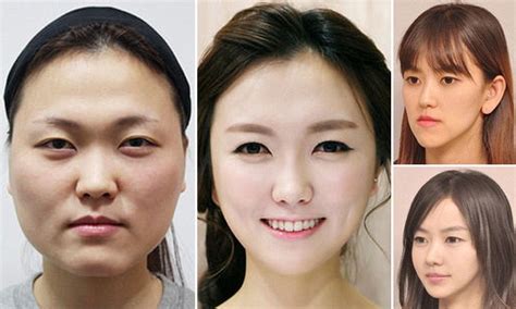 Plastic Surgery In South Korea Is So Good People Are Unrecognisable