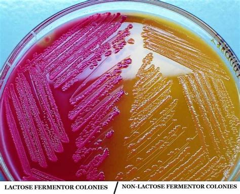 Macconkey Agar Composition Principle And Use Pharmasopcorner