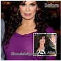 Marie Osmond Plastic Surgery Before and After Photos botox injections ...