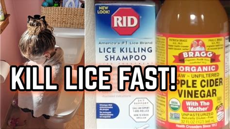 How To Get Rid Of Lice Fast 😲🦟 And Keep It From Coming Back Youtube
