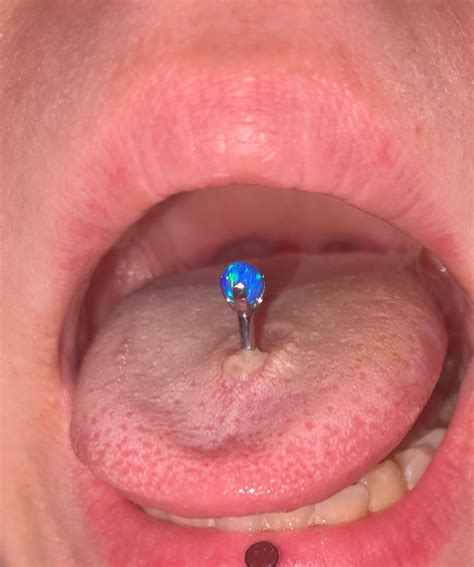 Tongue Piercing Infection Rpiercing