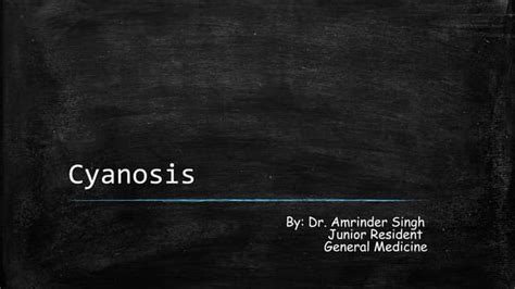 Understanding Cyanosis Causes Types And Treatment Ppt