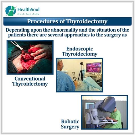 Thyroid Removal Surgery Overview Indications Preparation Procedure