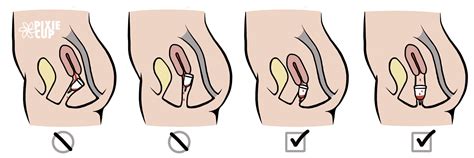 Maybe you would like to learn more about one of these? How do I use a menstrual cup with a tilted uterus? | Pixie ...