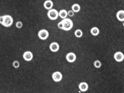 Cryptococcus Neoformans Microbewiki