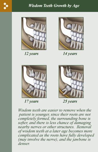 Wisdom Teeth Removal Bamonte Oral Surgery