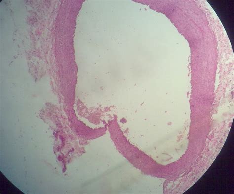 Lip Histology Labeled Sitelip Org Hot Sex Picture