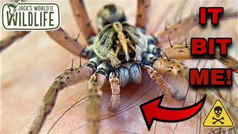 Wolf Spider Bite Are They Dangerous Youtube
