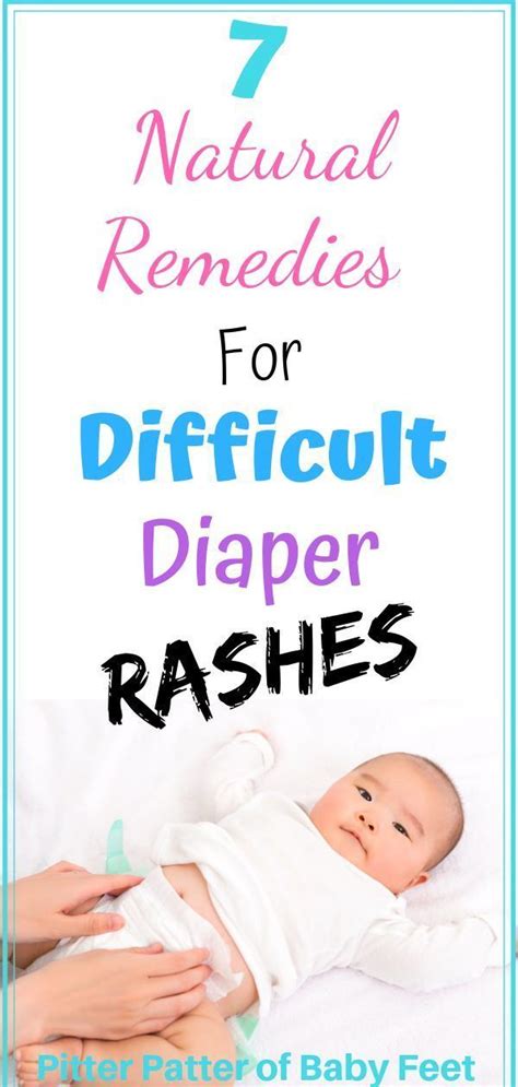 7 Natural Home Remedies To Soothe Your Babys Diaper Rash Baby