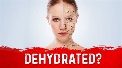 Are You Dehydrated Simple Test For Dehydration By Drberg Youtube