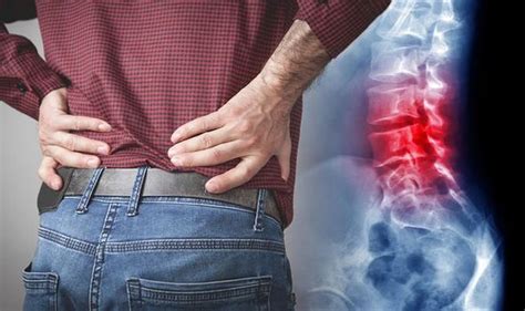 Back Pain A Certain Disease May Be Causing An Achy Back What Is It