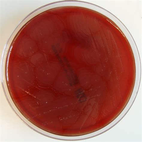 Proteus Mirabilis On Columbia Horse Blood Agar Swarming Gr Flickr