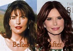 Roma Downey Plastic Surgery Before and After | Top Celebrity Surgery